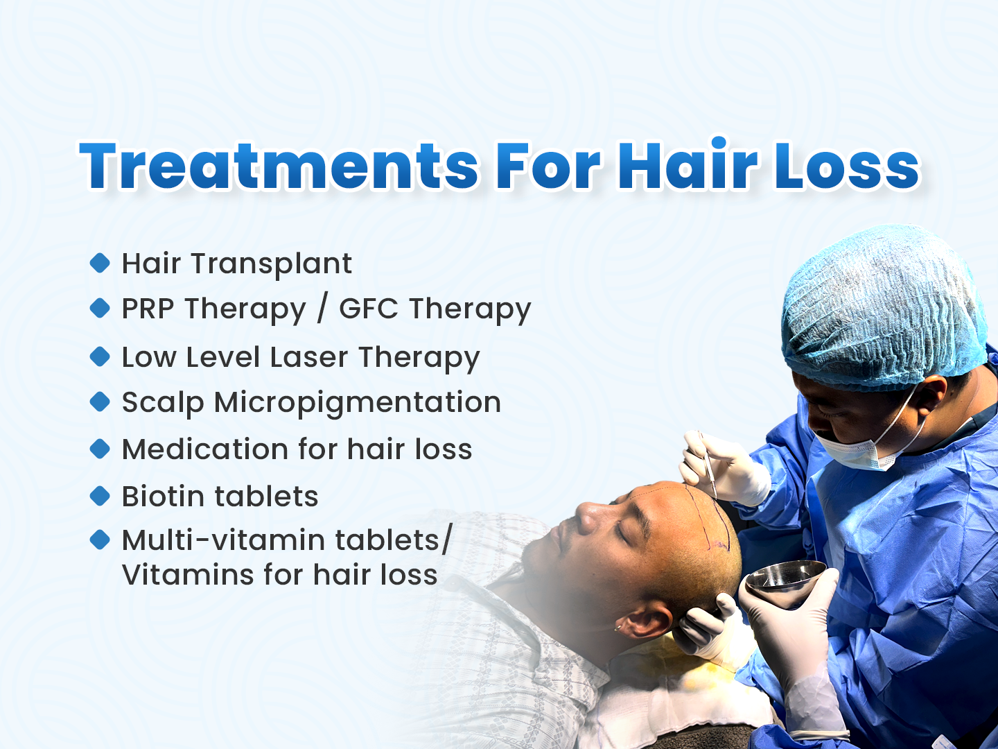 List of available hair loss treatments