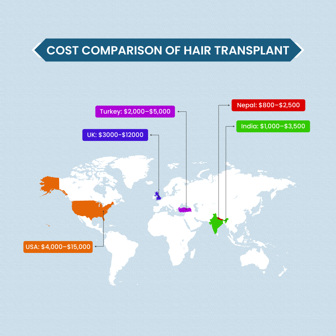 Infographic comparing hair transplant cost in Nepal, India, USA, Turkey, and the UK, highlighting affordability and quality options in Nepal